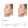 Spnico Beauty Nose Clips Silicone Straightener-2