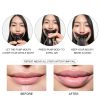Lip Plumping Device Sdtom Beauty-3
