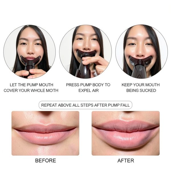 Lip Plumping Device Sdtom Beauty-3