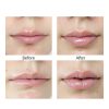 Lip Plumping Device by Pavo Beauty-3