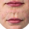 CurrentBody LED Lip Plumping Device Softening Lines-3